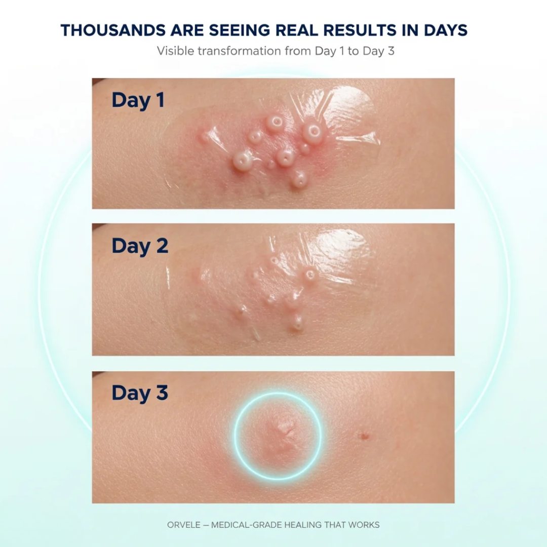 Dermelo™ Hydrocolloid Roll For Molluscum