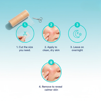 Dermelo™ Hydrocolloid Roll For Molluscum